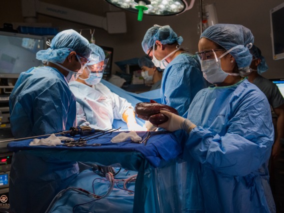 Surgeons in the OR room performing a transplant surgery