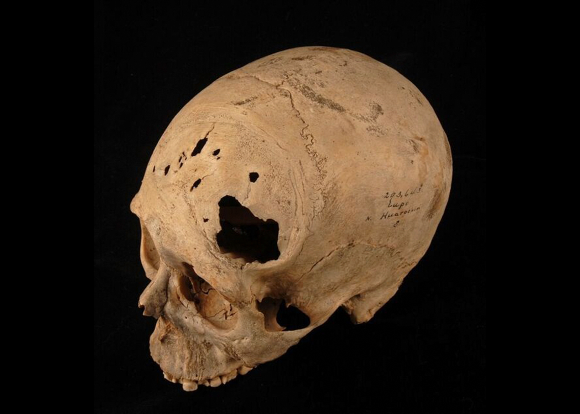 Cranium of adult male circa1000?1400 AD 