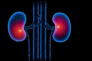Illuminated kidney image.