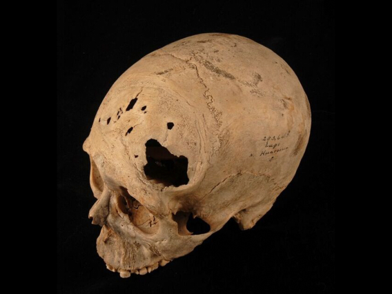 Cranium of adult male circa1000?1400 AD 