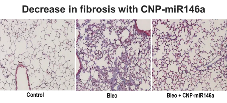 LFRB Figure 4