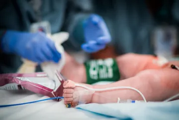 Infant on surgical table.
