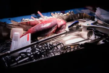 Human organ on surgical tray.