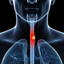 Illuminated esophagus image.